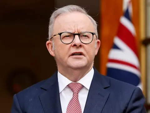 Anthony Albanese