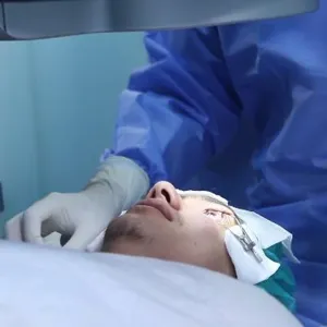 Ilustrasi tindakan LASIK