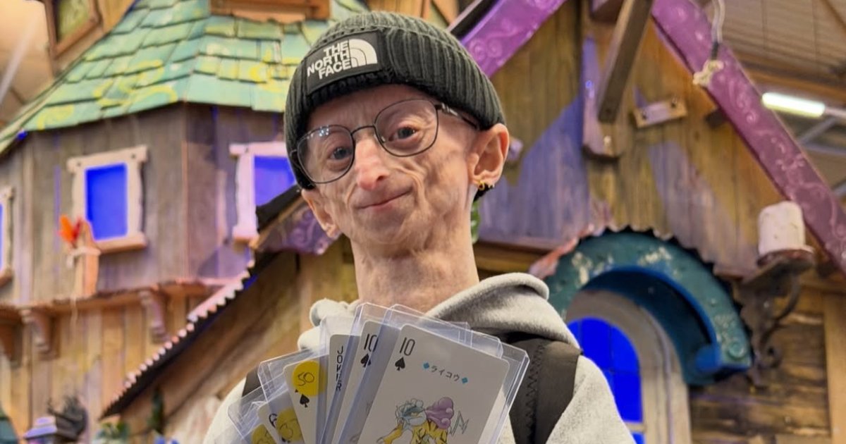 Michiel Vandeweert meninggal di usia 28 tahun setelah hidup dengan progeria.