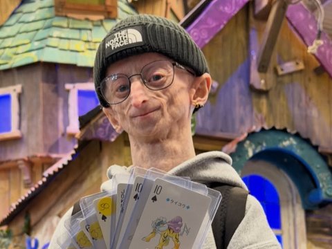 Michiel Vandeweert meninggal di usia 28 tahun setelah hidup dengan progeria.
