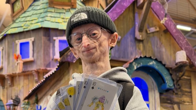 Michiel Vandeweert meninggal di usia 28 tahun setelah hidup dengan progeria.