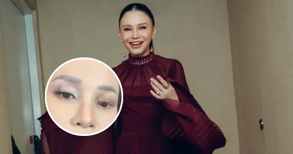 Rossa bintitan Rossa bintitan