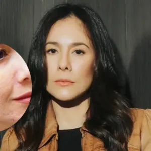 Wulan guritno kulit bertekstur bekas jerawat