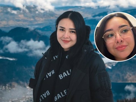 Amanda Manopo Mengalami Mata Minus Setelah Melahirkan