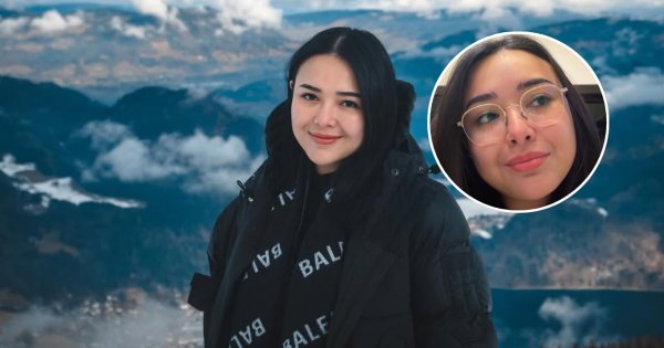 Amanda Manopo Mengalami Mata Minus Setelah Melahirkan