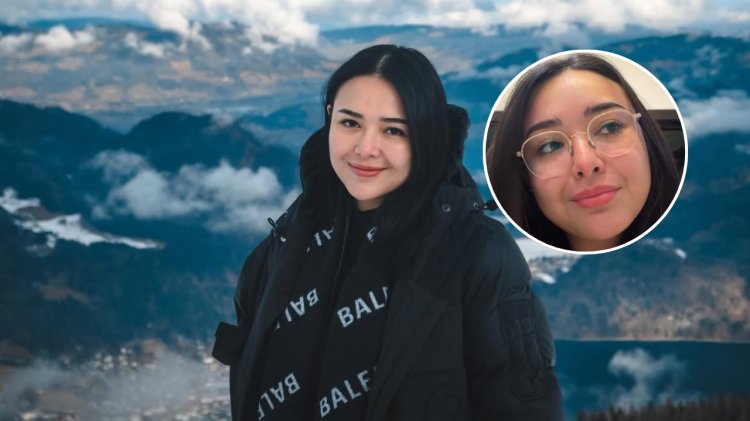 Amanda Manopo Mengalami Mata Minus Setelah Melahirkan