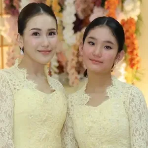 Ayu ting ting bilqis skincare remaja