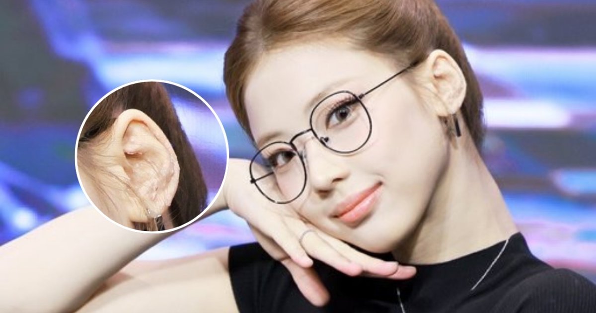 Ruka Babymonster Kenakan Ear Seeds di Telinga, Dipercaya Dapat Redakan Stres