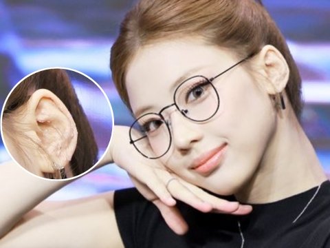Ruka Babymonster Kenakan Ear Seeds di Telinga, Dipercaya Dapat Redakan Stres