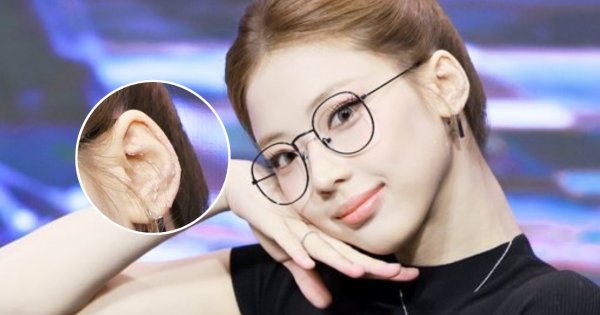 Ruka Babymonster Kenakan Ear Seeds di Telinga, Dipercaya Dapat Redakan Stres