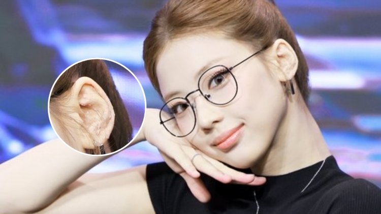 Ruka Babymonster Kenakan Ear Seeds di Telinga, Dipercaya Dapat Redakan Stres
