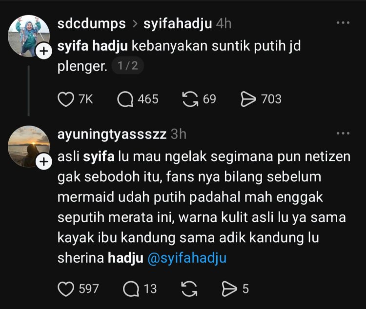 Syifa Hadju dituduh suntik putih (Foto: Dok. Threads)