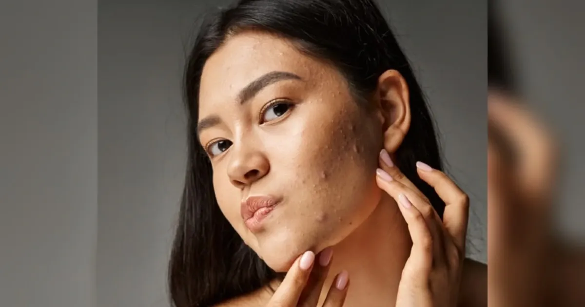 Makeup berjerawat