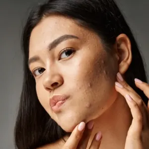 Makeup berjerawat