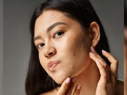Makeup berjerawat