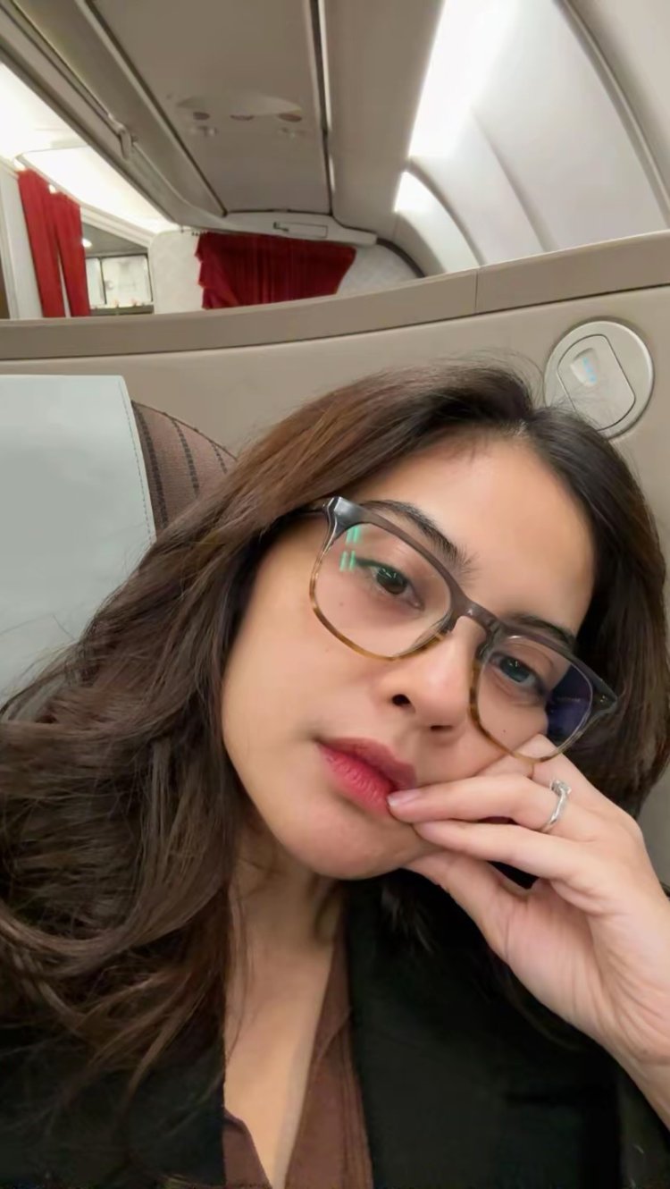 Wajah Tiwi T2 sebelum oplas. Foto: Dok. Instagram @tentangtiwi